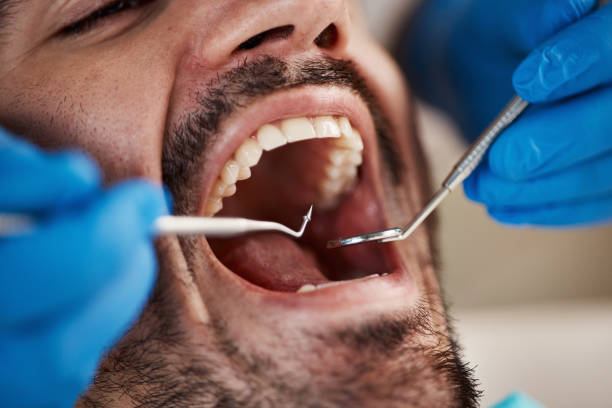 Best Emergency Broken Tooth Repair in Oak Grove, MN